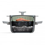 Друшляк-пароварка LEO BALANCE, силікон, діам. 24 см